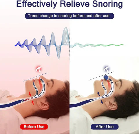 Micro-CPAP-Gerät – Kompakt, Tragbar & Geräuscharm | CPAP-Alternative für Reisen & Anti-Schnarch-Therapie
